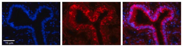 Anti-GSR antibody produced in rabbit affinity isolated antibody