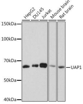 Anti-UAP1 Antibody, clone 5S7M2, Rabbit Monoclonal