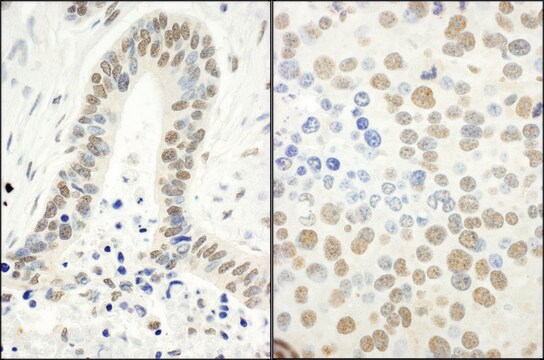 Rabbit anti-Phospho RPA32 (S4/S8) Antibody, Affinity Purified Powered by Bethyl Laboratories, Inc.