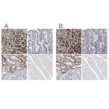 Anti-SGSH antibody produced in rabbit Prestige Antibodies&#174; Powered by Atlas Antibodies, affinity isolated antibody, buffered aqueous glycerol solution, Ab2