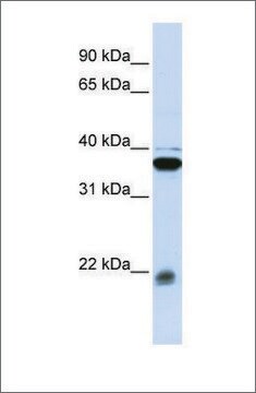 Anti-MYL9 antibody produced in rabbit affinity isolated antibody