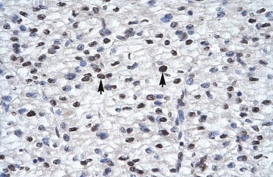 Anti-GLI2 antibody produced in rabbit affinity isolated antibody