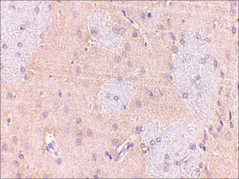 Anti-GPAT1 antibody produced in rabbit affinity isolated antibody, buffered aqueous solution