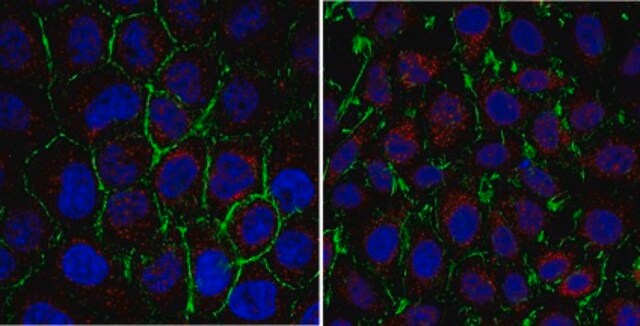 Anti-PSAT1 Antibody from rabbit, purified by affinity chromatography