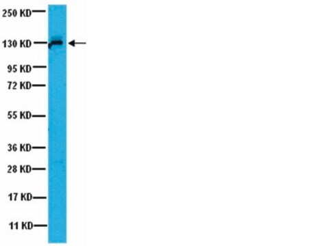 Anti-JAK1 Antibody from rabbit, purified by affinity chromatography