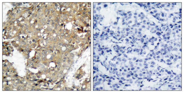 Anti-STAT1 antibody produced in rabbit affinity isolated antibody