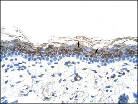 Anti-ZIC2 antibody produced in rabbit affinity isolated antibody