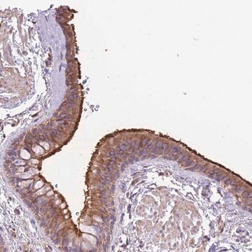 Anti-RHOU antibody produced in rabbit Prestige Antibodies&#174; Powered by Atlas Antibodies, affinity isolated antibody, buffered aqueous glycerol solution