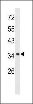 ANTI-ANNEXIN A1 (CENTER) antibody produced in rabbit purified immunoglobulin, buffered aqueous solution