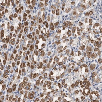 Anti-DHX58 antibody produced in rabbit Prestige Antibodies&#174; Powered by Atlas Antibodies, affinity isolated antibody, buffered aqueous glycerol solution, Ab2