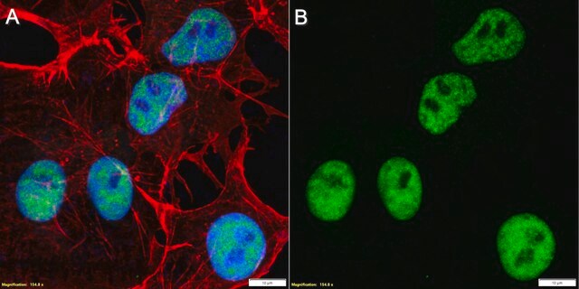 Anti-SV40 T Antigen Antibody, clone PAb416 ZooMAb&#174; Mouse Monoclonal recombinant, expressed in HEK 293 cells