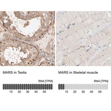 Anti-MARS antibody produced in rabbit affinity isolated antibody, buffered aqueous glycerol solution