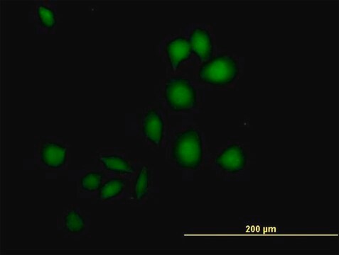 抗DSCR1抗体 マウス宿主抗体 purified immunoglobulin, buffered aqueous solution