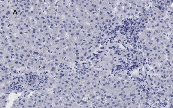 Anti-LDL Receptor Antibody, clone 2N19, ZooMAb&#174; Rabbit Monoclonal recombinant, expressed in HEK 293 cells