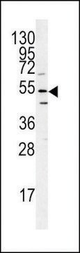 ANTI-ATG14(N-TERMINAL) antibody produced in rabbit purified immunoglobulin, buffered aqueous solution