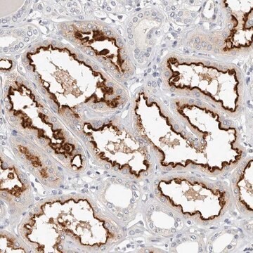 Anti-TMEM63B antibody produced in rabbit Prestige Antibodies&#174; Powered by Atlas Antibodies, affinity isolated antibody, buffered aqueous glycerol solution