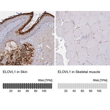 Anti-ELOVL1 antibody produced in rabbit Prestige Antibodies&#174; Powered by Atlas Antibodies, affinity isolated antibody, buffered aqueous glycerol solution