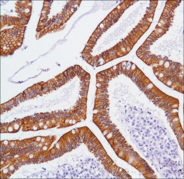 Anti-C-ERBB3 antibody, Rabbit monoclonal clone SP71, recombinant, expressed in proprietary host, affinity isolated antibody