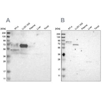 抗FRMD5 ウサギ宿主抗体 Ab1, Prestige Antibodies&#174; Powered by Atlas Antibodies, affinity isolated antibody, buffered aqueous glycerol solution