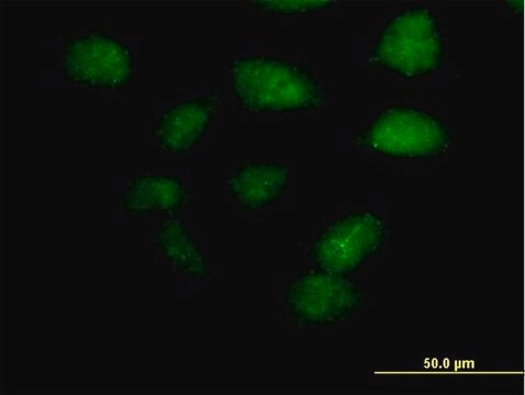 Anti-ZBTB32 antibody produced in mouse purified immunoglobulin, buffered aqueous solution