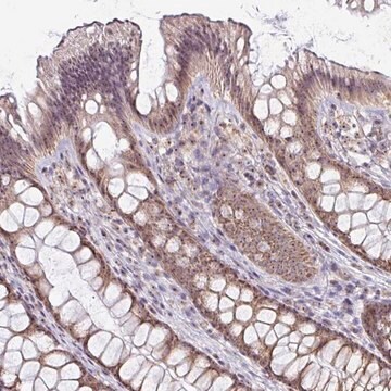 Anti-NACC2 antibody produced in rabbit Prestige Antibodies&#174; Powered by Atlas Antibodies, affinity isolated antibody, buffered aqueous glycerol solution