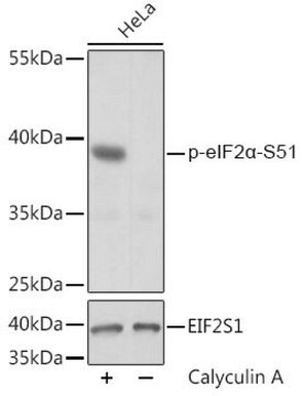 Anti-Phospho-eIF2&#945;-S51 antibody produced in rabbit