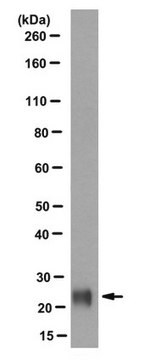 Anti-VSNL1 Antibody, clone 2D11 clone 2D11, from mouse