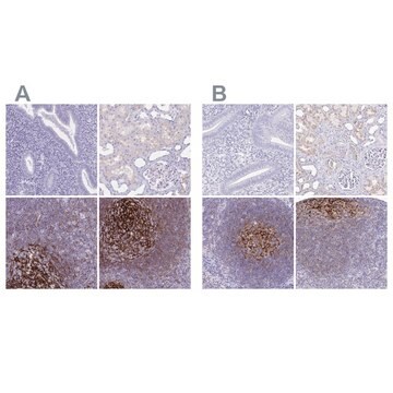 Anti-CR2 antibody produced in rabbit Prestige Antibodies&#174; Powered by Atlas Antibodies, affinity isolated antibody, buffered aqueous glycerol solution