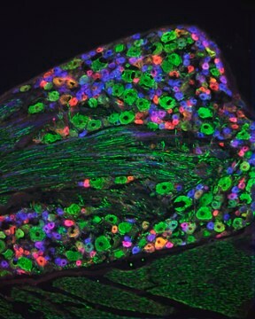 モノクロナール抗ニューロフィラメント160/200 マウス宿主抗体 ~2&#160;mg/mL, clone RMdO20, purified from hybridoma cell culture