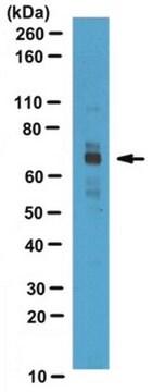 Anti-CPT2-Antikörper serum, from rabbit