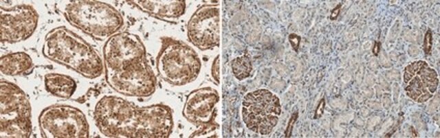 Anty-Wilms Tumor (WT33) from rabbit, purified by affinity chromatography