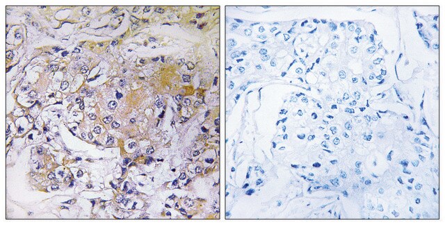 Anti-ULK3 antibody produced in rabbit affinity isolated antibody