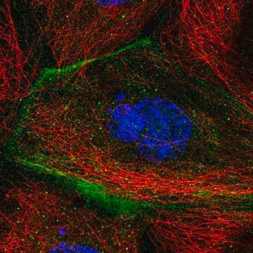 Anti-TMEM63B antibody produced in rabbit Prestige Antibodies&#174; Powered by Atlas Antibodies, affinity isolated antibody