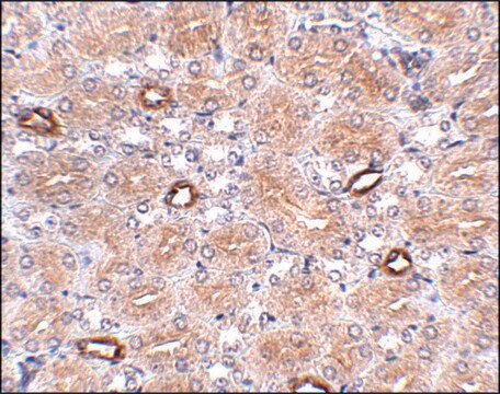 Anti-NOTUM antibody produced in rabbit affinity isolated antibody, buffered aqueous solution