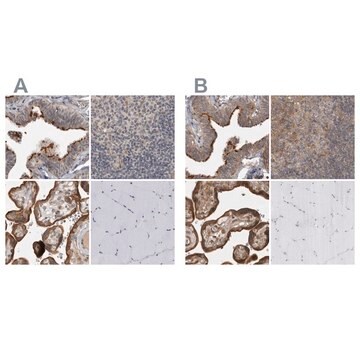 Anti-LRRC45 antibody produced in rabbit Prestige Antibodies&#174; Powered by Atlas Antibodies, affinity isolated antibody, buffered aqueous glycerol solution