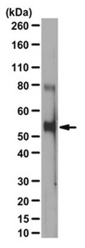 Anti-phospho Beclin-Antikörper (Thr119) from rabbit, purified by affinity chromatography