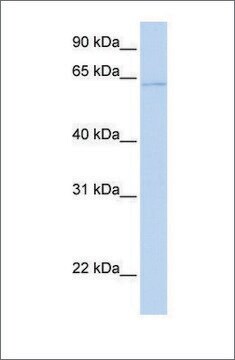 Anti-PPAT antibody produced in rabbit affinity isolated antibody