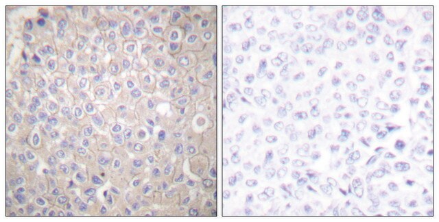 抗 E-钙黏蛋白 兔抗 affinity isolated antibody