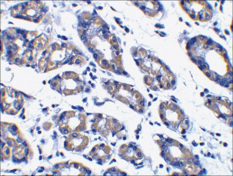 Anti-NOXA antibody produced in rabbit affinity isolated antibody, buffered aqueous solution