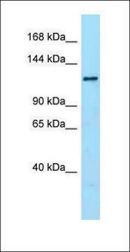 Anti-DENND1A antibody produced in rabbit affinity isolated antibody