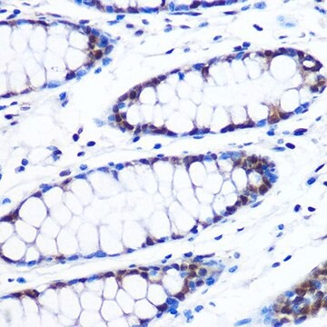 Anti-BRD4 antibody produced in rabbit