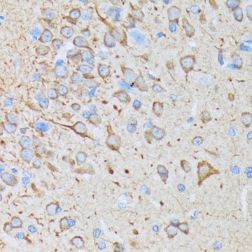 Anti-CaMKII Antibody, clone 7L9F0, Rabbit Monoclonal