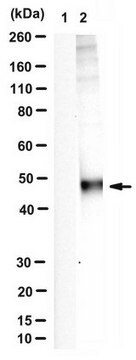 Anti-phospho Rab1 (Thr75) from rabbit