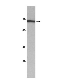 Anti-&#946;-Catenin-Antikörper, Klon 2H4A7 clone 2H4A7, Upstate&#174;, from mouse