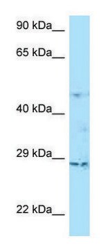 Anti-TNAIP6 (C-terminal) antibody produced in rabbit affinity isolated antibody