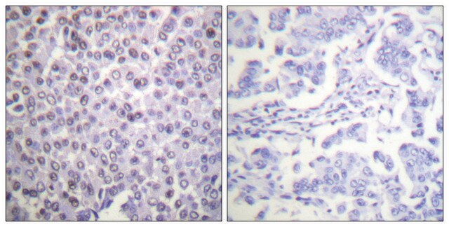 Anti-Histone H4 antibody produced in rabbit affinity isolated antibody