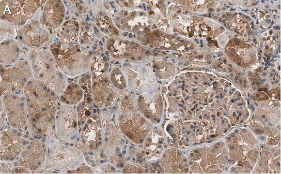 抗FTO抗体 クローン4B21 ZooMAb&#174;ウサギモノクローナル recombinant, expressed in HEK 293 cells