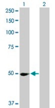 Anti-PPM1F antibody produced in rabbit purified immunoglobulin, buffered aqueous solution