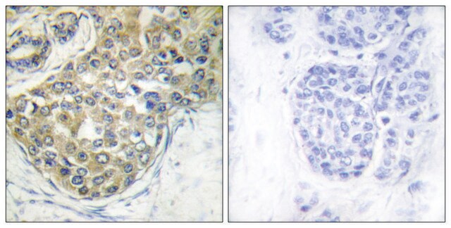 Anti-phospho-ACK1 (pTyr284) antibody produced in rabbit affinity isolated antibody