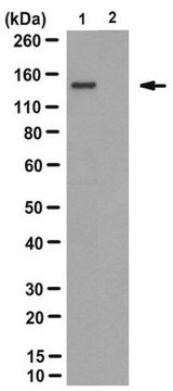 Anticorpo anti-proteine con poliQ associate a malattia, clone 3B5H10 clone 3B5H10, from mouse